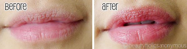 Fresh Sugar Rose Lip Treatment SPF15 Before and After