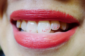 What Would You Do #1: Excuse Me, You've Got Lipstick On Your Teeth