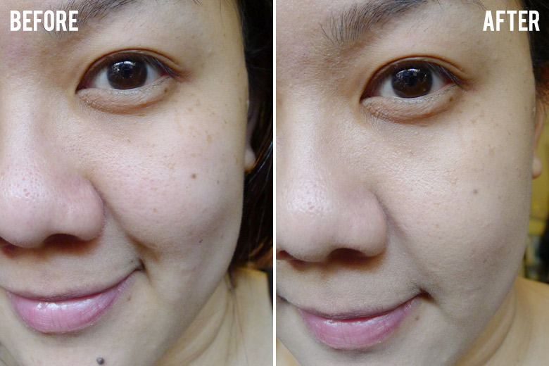 Clinelle Miracle Aqua Capsule EE Even Effect Cream Before and After